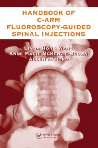 Könyv Handbook of C-Arm Fluoroscopy-Guided Spinal Injections Linda Hong Wang