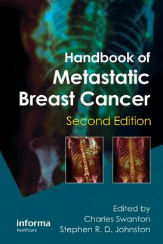 Book Handbook of Metastatic Breast Cancer 