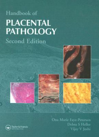 Knjiga Handbook of Placental Pathology Vijay V. Joshi