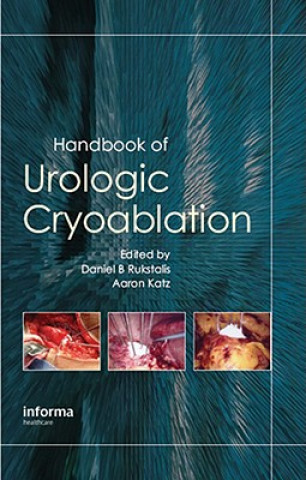 Carte Handbook of Urologic Cryoablation Daniel Rukstalis