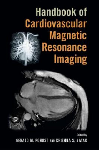 Carte Handbook of Cardiovascular Magnetic Resonance Imaging Gerald M. Pohost