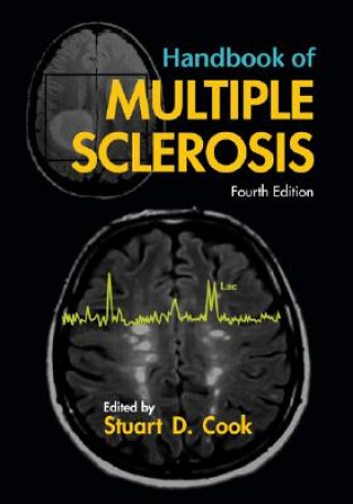 Knjiga Handbook of Multiple Sclerosis Stuart D. Cook