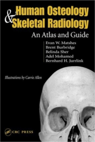 Kniha Human Osteology and Skeletal Radiology Bernard Juurlink