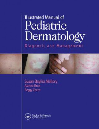 Книга Illustrated Manual of Pediatric Dermatology Peggy Chern