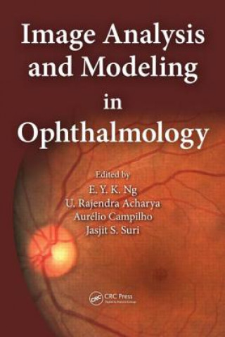 Könyv Image Analysis and Modeling in Ophthalmology 