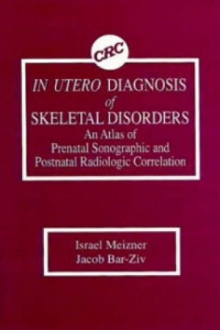 Könyv In Utero Diagnosis of Skeletal Disorders Jacob Bar-Ziv
