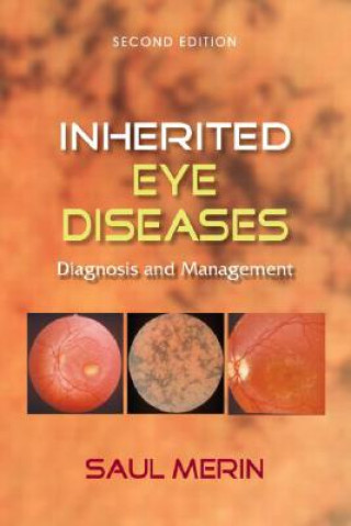 Книга Inherited Eye Diseases Merin Saul