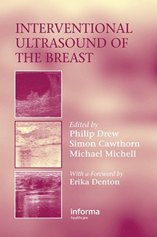 Kniha Interventional Ultrasound of the Breast 