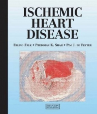 Книга Ischemic Heart Disease Pim De Feyter