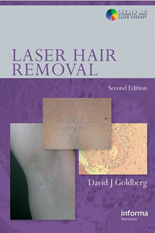 Книга Laser Hair Removal 