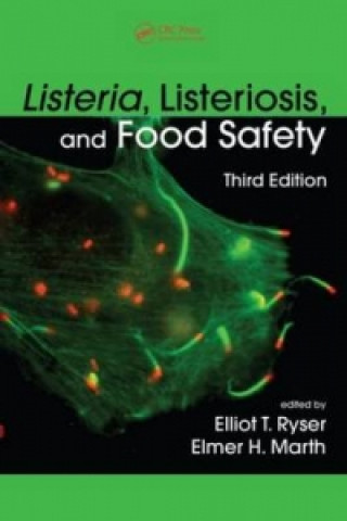 Carte Listeria, Listeriosis, and Food Safety 