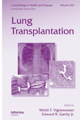 Könyv Lung Transplantation 