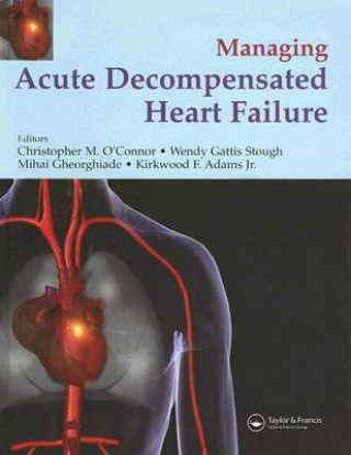 Książka Management of Acute Decompensated Heart Failure 