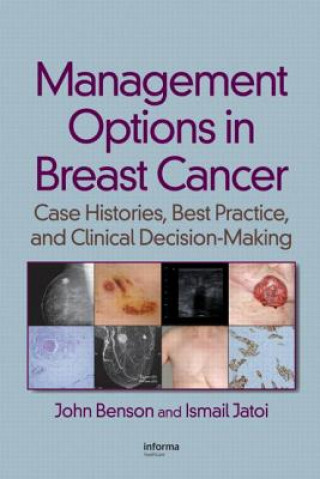 Buch Management Options in Breast Cancer Ismail Jatoi