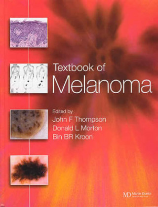 Kniha Textbook of Melanoma Bin B. R. Kroon