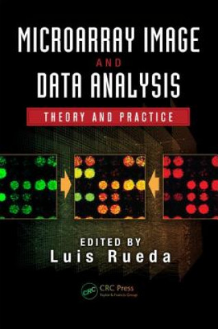 Buch Microarray Image and Data Analysis Luis Rueda