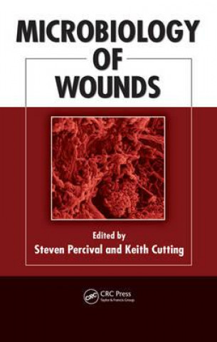 Carte Microbiology of Wounds 