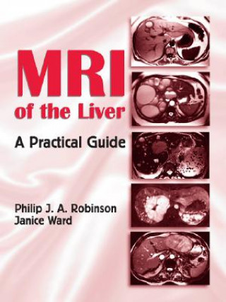 Carte MRI of the Liver Janice Ward