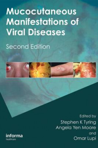 Könyv Mucocutaneous Manifestations of Viral Diseases 