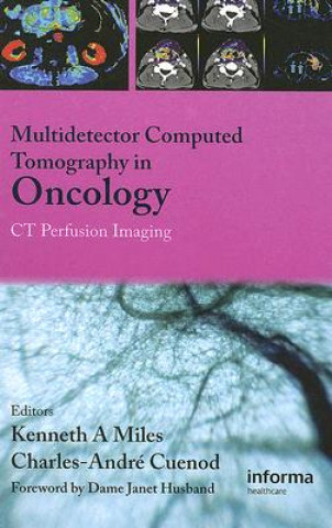 Knjiga Multi-Detector Computed Tomography in Oncology Kenneth Miles