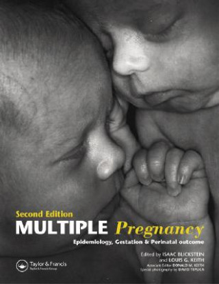 Knjiga Multiple Pregnancy Louis G. Keith