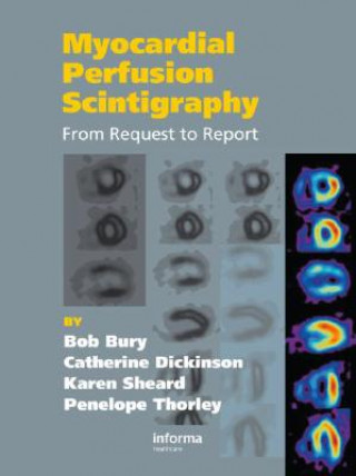 Könyv Myocardial Perfusion Scintigraphy Catherine Dickinson