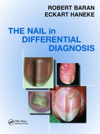 Könyv Nail in Differential Diagnosis Eckart Haneke