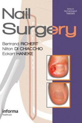 Книга Nail Surgery 