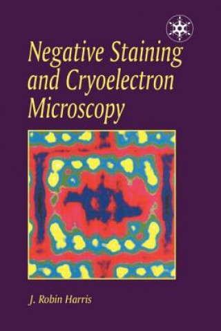 Knjiga Negative Staining and Cryoelectron Microscopy James Robin Harris
