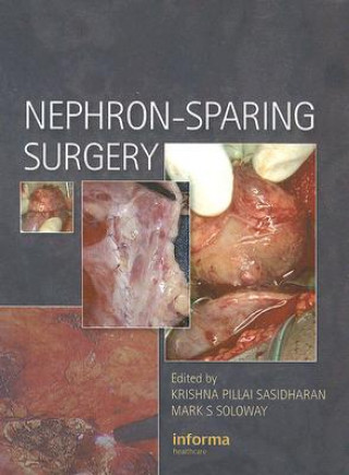 Libro Nephron-Sparing Surgery Krishna Sasidharan