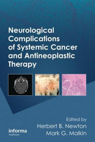 Kniha Neurological Complications of Systemic Cancer and Antineoplastic Therapy 