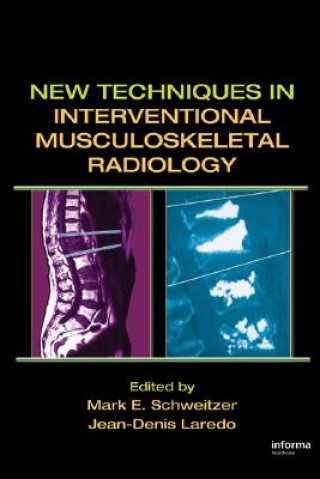 Książka New Techniques in Interventional Musculoskeletal Radiology 