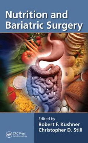 Carte Nutrition and Bariatric Surgery 