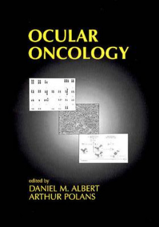 Knjiga Ocular Oncology Daniel M. Albert