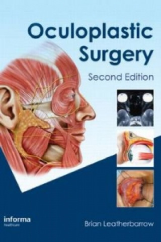 Книга Oculoplastic Surgery Brian Leatherbarrow