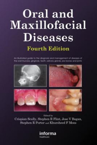 Kniha Oral and Maxillofacial Diseases, Fourth Edition Jose V. Bagan