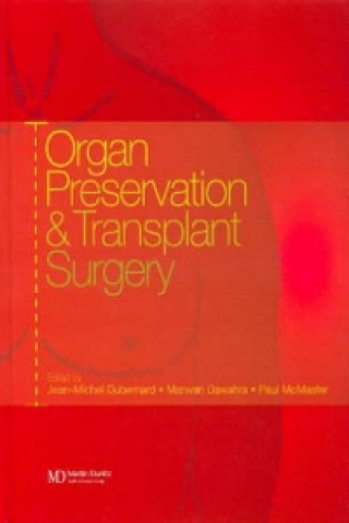 Carte Organ Preservation and Transplant Surgery Paul McMaster