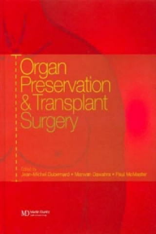 Buch Organ Preservation and Transplant Surgery Paul McMaster