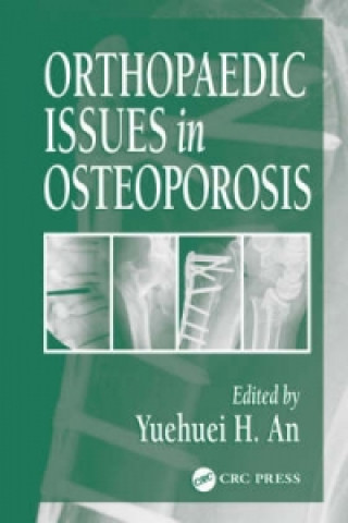 Kniha Orthopaedic Issues in Osteoporosis Yuehuei H. An