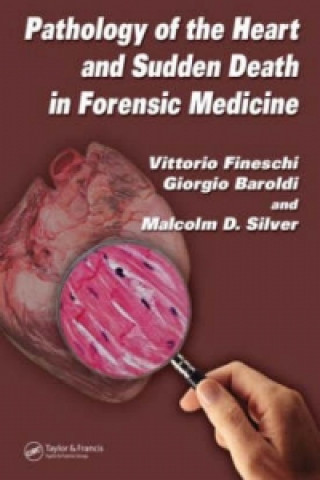 Könyv Pathology of the Heart and Sudden Death in Forensic Medicine Malcolm D. Silver