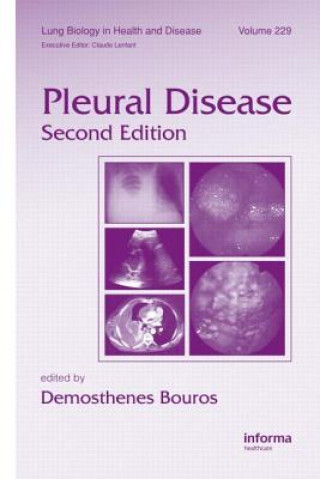 Książka Pleural Disease 