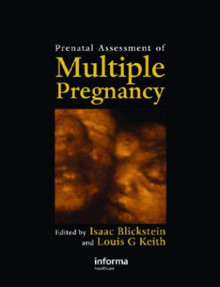 Carte Prenatal Assessment of Multiple Pregnancy 