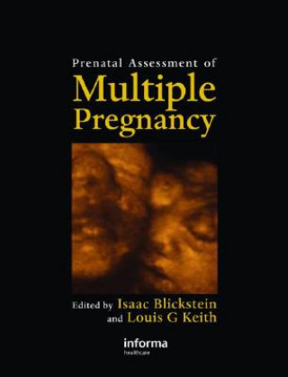 Kniha Prenatal Assessment of Multiple Pregnancy 