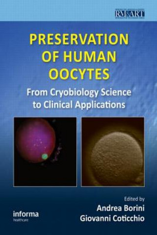 Книга Preservation of Human Oocytes 