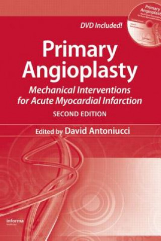 Kniha Primary Angioplasty 