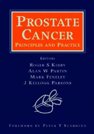 Kniha Prostate Cancer 