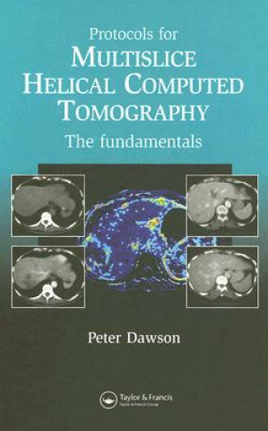 Könyv Protocols for Multislice Helical Computed Tomography Peter Dawson
