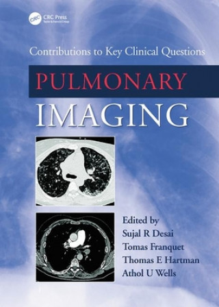 Knjiga Pulmonary Imaging Athol Wells