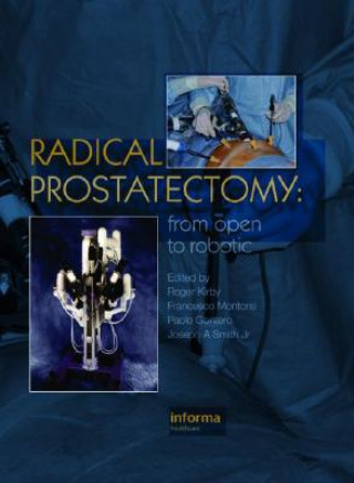 Könyv Radical Prostatectomy 