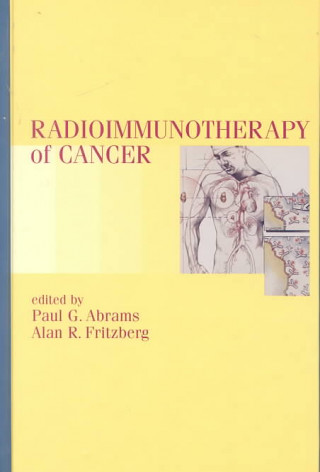 Livre Radioimmunotherapy of Cancer Alan R. Fritzberg